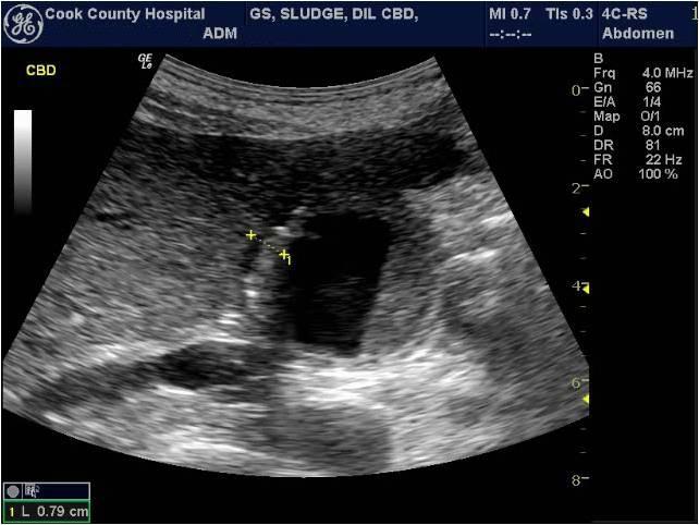 GE LOGIQ e Ultrasound For Sale - Image 11