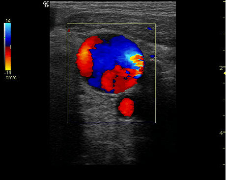 GE LOGIQ e Ultrasound For Sale - Image 4
