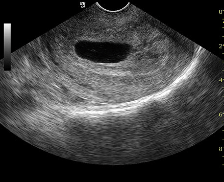 GE LOGIQ e Ultrasound For Sale - Image 5
