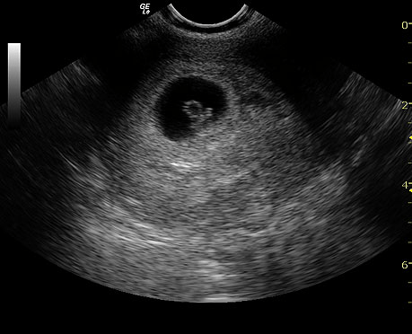 GE LOGIQ e Ultrasound For Sale - Image 6