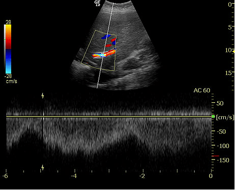 GE LOGIQ e Ultrasound For Sale - Image 7