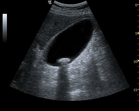 GE LOGIQ e Ultrasound For Sale - Image 8