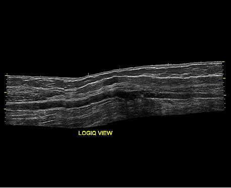 GE LOGIQ e Ultrasound For Sale - Image 9