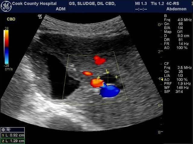 GE LOGIQ e Ultrasound For Sale - Image 10
